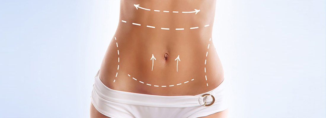 Abdominal Aesthetics - Op. Dr. Şükrü İşler Estetik Kliniği