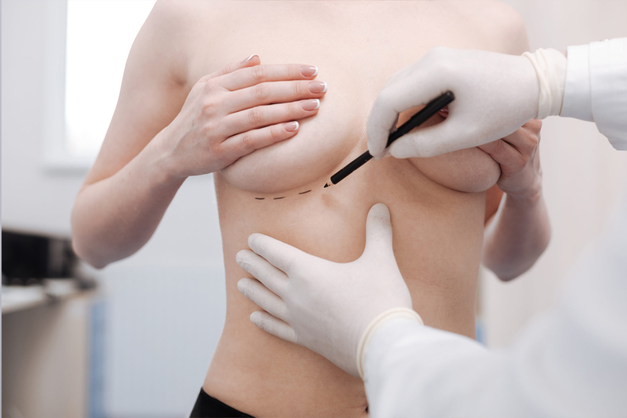 Breast Aesthetics - Op. Dr. Şükrü İşler Estetik Kliniği