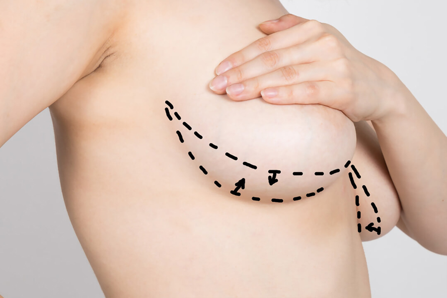 Breast Aesthetics - Op. Dr. Şükrü İşler Estetik Kliniği